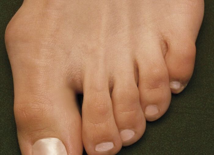 Aerosoft&reg; Flex Stretch-Klettslipper von J&uuml;rgen Hirsch&reg; 