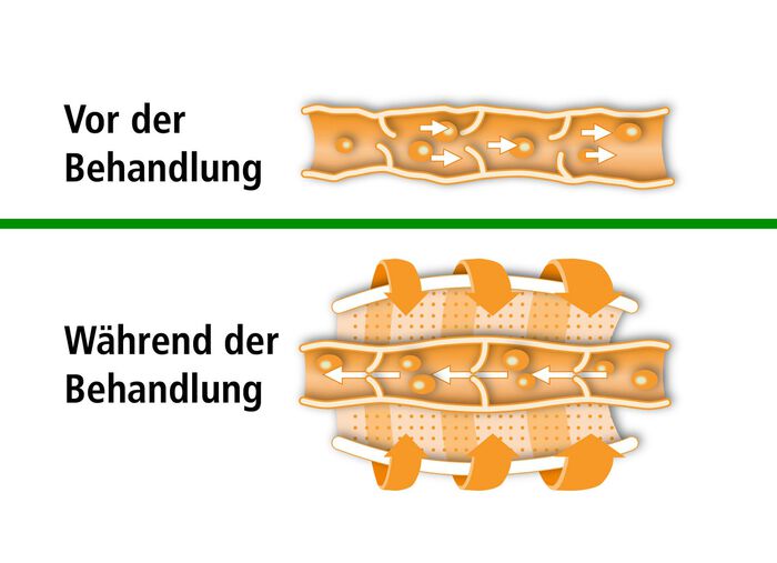 Beurer Venen-Massageger&auml;t FM 150 BLAU