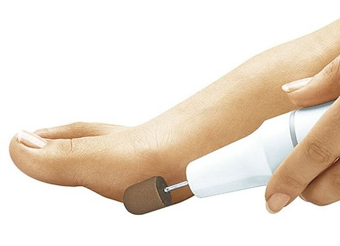 Fusspflegeschleifkappen-Set, 11-teilig 